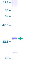 GNG3 Protein - 12.5% SDS-PAGE of human GNG3 stained with Coomassie Blue