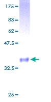 GNG4 Protein - 12.5% SDS-PAGE of human GNG4 stained with Coomassie Blue