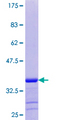 GNG8 Protein - 12.5% SDS-PAGE of human GNG8 stained with Coomassie Blue