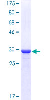 GNGT1 Protein - 12.5% SDS-PAGE of human GNGT1 stained with Coomassie Blue
