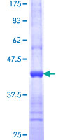 GNL1 Protein - 12.5% SDS-PAGE Stained with Coomassie Blue.