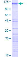 GNL2 Protein - 12.5% SDS-PAGE of human GNL2 stained with Coomassie Blue