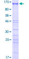 GNL2 Protein - 12.5% SDS-PAGE of human GNL2 stained with Coomassie Blue