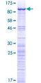 GNL3 / NS / Nucleostemin Protein - 12.5% SDS-PAGE of human GNL3 stained with Coomassie Blue