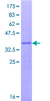 GNL3 / NS / Nucleostemin Protein - 12.5% SDS-PAGE Stained with Coomassie Blue.