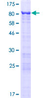 GNL3L Protein - 12.5% SDS-PAGE of human GNL3L stained with Coomassie Blue