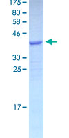 GNLY / Granulysin Protein - 12.5% SDS-PAGE of human GNLY stained with Coomassie Blue