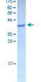GNLY / Granulysin Protein - 12.5% SDS-PAGE of human GNLY stained with Coomassie Blue