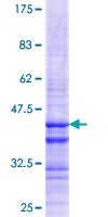 GNLY / Granulysin Protein - 12.5% SDS-PAGE Stained with Coomassie Blue.