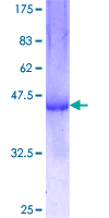 GNMT Protein - 12.5% SDS-PAGE Stained with Coomassie Blue.