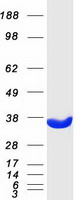 GNMT Protein - Purified recombinant protein GNMT was analyzed by SDS-PAGE gel and Coomassie Blue Staining