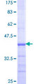 GNPAT / DHAP-AT Protein - 12.5% SDS-PAGE Stained with Coomassie Blue.