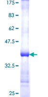 GNPDA1 Protein - 12.5% SDS-PAGE Stained with Coomassie Blue.