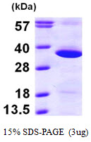 GNPDA1 Protein