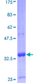 GNRH Protein - 12.5% SDS-PAGE of human GNRH1 stained with Coomassie Blue