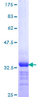 GNRH Protein - 12.5% SDS-PAGE Stained with Coomassie Blue.
