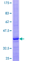GNRH2 Protein - 12.5% SDS-PAGE of human GNRH2 stained with Coomassie Blue