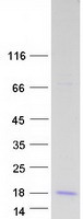GNRH2 Protein - Purified recombinant protein GNRH2 was analyzed by SDS-PAGE gel and Coomassie Blue Staining