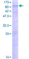 GNS Protein - 12.5% SDS-PAGE of human GNS stained with Coomassie Blue