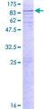 GNS Protein - 12.5% SDS-PAGE of human GNS stained with Coomassie Blue