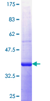 GNS Protein - 12.5% SDS-PAGE Stained with Coomassie Blue.