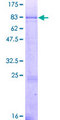 GNT-III / MGAT3 Protein - 12.5% SDS-PAGE of human MGAT3 stained with Coomassie Blue
