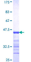 GNT-III / MGAT3 Protein - 12.5% SDS-PAGE Stained with Coomassie Blue.