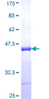 GNT-V / MGAT5 Protein - 12.5% SDS-PAGE Stained with Coomassie Blue.