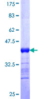 GOB5 / CLCA1 Protein - 12.5% SDS-PAGE Stained with Coomassie Blue.