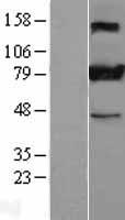 GOK / STIM1 Protein - Western validation with an anti-DDK antibody * L: Control HEK293 lysate R: Over-expression lysate
