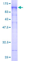 GOK / STIM1 Protein - 12.5% SDS-PAGE of human STIM1 stained with Coomassie Blue
