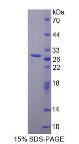 GOK / STIM1 Protein - Recombinant Stromal Interaction Molecule 1 By SDS-PAGE