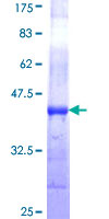 GOLGA1 / Golgin-97 Protein - 12.5% SDS-PAGE Stained with Coomassie Blue.