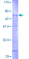 GOLGA2 / GM130 Protein - 12.5% SDS-PAGE of human GOLGA2 stained with Coomassie Blue