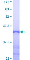 GOLGA2 / GM130 Protein - 12.5% SDS-PAGE Stained with Coomassie Blue.
