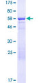 GOLGA6L9 Protein - 12.5% SDS-PAGE of human LOC440295 stained with Coomassie Blue