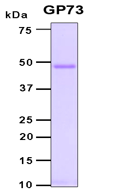 GOLM1 / GP73 / GOLPH2 Protein