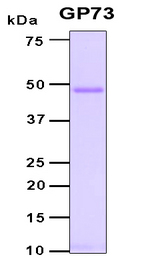 GOLM1 / GP73 / GOLPH2 Protein