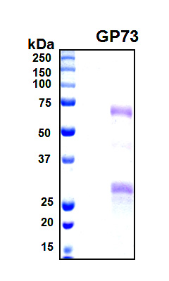GOLM1 / GP73 / GOLPH2 Protein - SDS-PAGE under reducing conditions and visualized by Coomassie blue staining