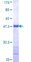 GOLM1 / GP73 / GOLPH2 Protein - 12.5% SDS-PAGE Stained with Coomassie Blue.