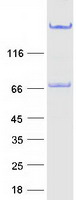 GOLM1 / GP73 / GOLPH2 Protein - Purified recombinant protein GOLM1 was analyzed by SDS-PAGE gel and Coomassie Blue Staining