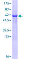 GOLPH3 Protein - 12.5% SDS-PAGE of human GOLPH3 stained with Coomassie Blue