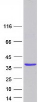 GOLPH3 Protein - Purified recombinant protein GOLPH3 was analyzed by SDS-PAGE gel and Coomassie Blue Staining