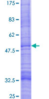 GOLT1B Protein - 12.5% SDS-PAGE of human GOLT1B stained with Coomassie Blue