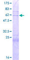 GORAB / SCYL1BP1 Protein - 12.5% SDS-PAGE of human SCYL1BP1 stained with Coomassie Blue