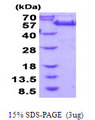 GORASP2 / GRASP55 Protein
