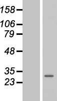 GOSR2 / Membrin Protein - Western validation with an anti-DDK antibody * L: Control HEK293 lysate R: Over-expression lysate