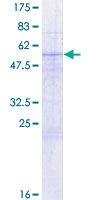 GOSR2 / Membrin Protein - 12.5% SDS-PAGE of human GOSR2 stained with Coomassie Blue