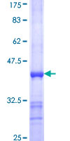 GOT2 Protein - 12.5% SDS-PAGE Stained with Coomassie Blue.