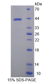 GOT2 Protein - Recombinant Aspartate Aminotransferase 2 By SDS-PAGE
